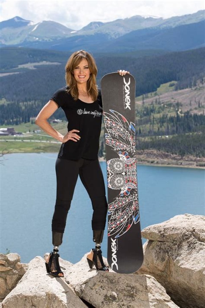 Amy Purdy biografía, edad, altura, esposa, net worth, familia